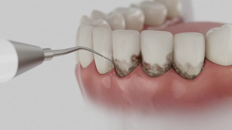 Trusted Tooth Extraction service in Konawa, OK - Dentist Open Now